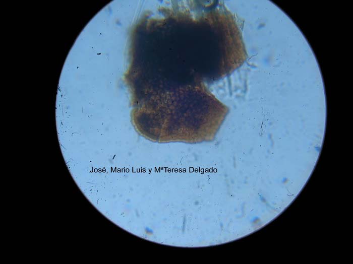 Licea minima microscopia